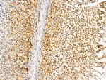 POLQ Antibody in Immunohistochemistry (Paraffin) (IHC (P))