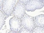 POLQ Antibody in Immunohistochemistry (Paraffin) (IHC (P))