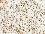 POLQ Antibody in Immunohistochemistry (Paraffin) (IHC (P))
