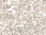 POLQ Antibody in Immunohistochemistry (Paraffin) (IHC (P))
