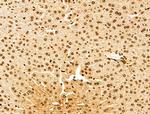 POLQ Antibody in Immunohistochemistry (Paraffin) (IHC (P))