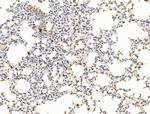 POLQ Antibody in Immunohistochemistry (Paraffin) (IHC (P))