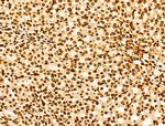 POLQ Antibody in Immunohistochemistry (Paraffin) (IHC (P))