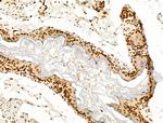 POLQ Antibody in Immunohistochemistry (Paraffin) (IHC (P))