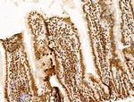 POLQ Antibody in Immunohistochemistry (Paraffin) (IHC (P))