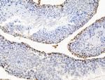 POLQ Antibody in Immunohistochemistry (Paraffin) (IHC (P))