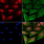 DNA2 Antibody in Immunocytochemistry (ICC/IF)