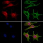 DNA2 Polyclonal Antibody