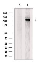 DNA2 Antibody in Western Blot (WB)