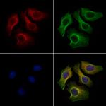 DNAH1 Polyclonal Antibody