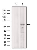 DNAJC7 Antibody in Western Blot (WB)
