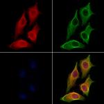 DNase II Polyclonal Antibody