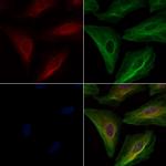 DOCK2 Polyclonal Antibody