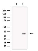 Prodynorphin Polyclonal Antibody