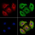 MAPRE3 Polyclonal Antibody