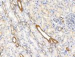 ECM2 Polyclonal Antibody