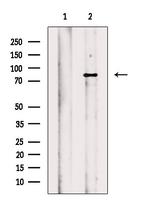 EEF2K Polyclonal Antibody