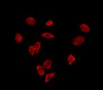 eIF4A3 Polyclonal Antibody