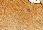 eIF4A3 Antibody in Immunohistochemistry (Paraffin) (IHC (P))