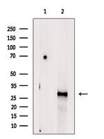 CELA3B Antibody in Western Blot (WB)