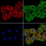 COL15A1 Polyclonal Antibody