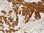 COL15A1 Antibody in Immunohistochemistry (Paraffin) (IHC (P))