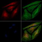 ENTPD5 Polyclonal Antibody