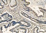 ENTPD5 Antibody in Immunohistochemistry (Paraffin) (IHC (P))