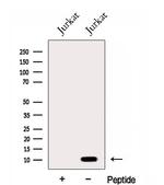 ENY2 Antibody in Western Blot (WB)