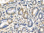 EphB6 Polyclonal Antibody