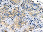 EphB6 Antibody in Immunohistochemistry (Paraffin) (IHC (P))
