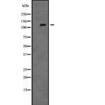 EphB6 Antibody in Western Blot (WB)