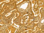 ERLIN2 Antibody in Immunohistochemistry (Paraffin) (IHC (P))