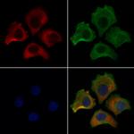 ERO1L Polyclonal Antibody