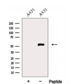 ERO1L Antibody in Western Blot (WB)