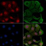 SMG6 Polyclonal Antibody