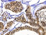 XPO5 Antibody in Immunohistochemistry (Paraffin) (IHC (P))