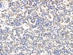 XPO5 Antibody in Immunohistochemistry (Paraffin) (IHC (P))