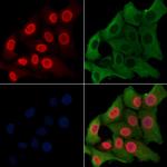 EZH1 Polyclonal Antibody