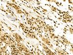 EZH1 Antibody in Immunohistochemistry (Paraffin) (IHC (P))