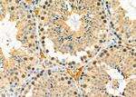 FABP4 Polyclonal Antibody