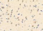 FABP4 Antibody in Immunohistochemistry (Paraffin) (IHC (P))