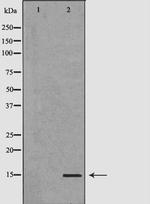 FABP4 Antibody in Western Blot (WB)