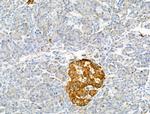 Factor VII Antibody in Immunohistochemistry (Paraffin) (IHC (P))