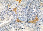 FASTKD5 Polyclonal Antibody