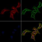 FAS (CD95) Polyclonal Antibody