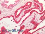 FAS (CD95) Antibody in Immunohistochemistry (Paraffin) (IHC (P))