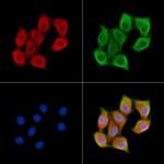 Myosin Heavy Chain Polyclonal Antibody