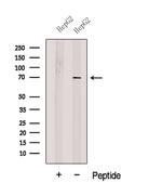 SLC27A4 Polyclonal Antibody