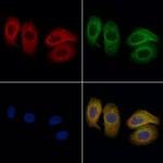 FceR1 alpha Polyclonal Antibody